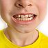 Manchas blancas en los dientes de tu hijo: la primera señal de alarma